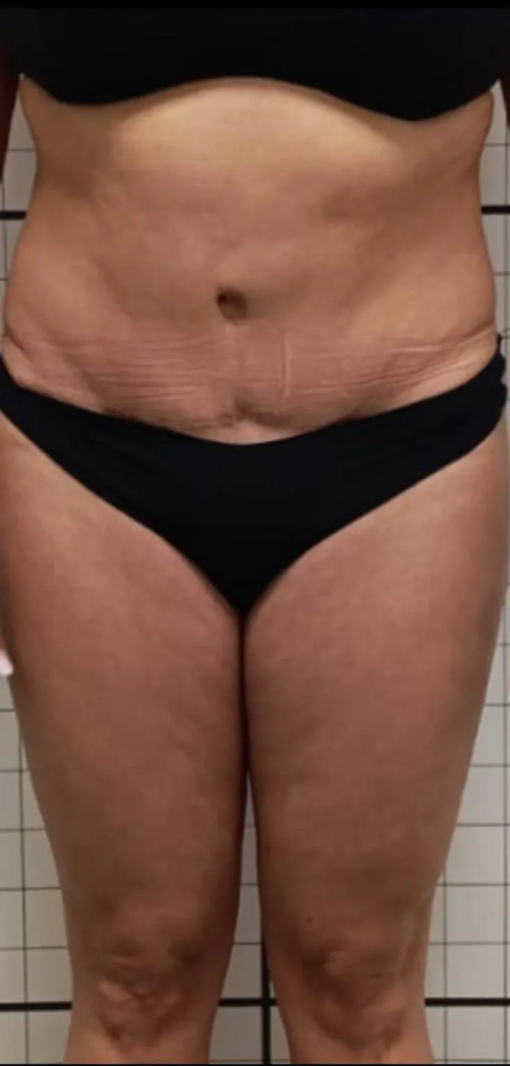 Prima trattamento corpo