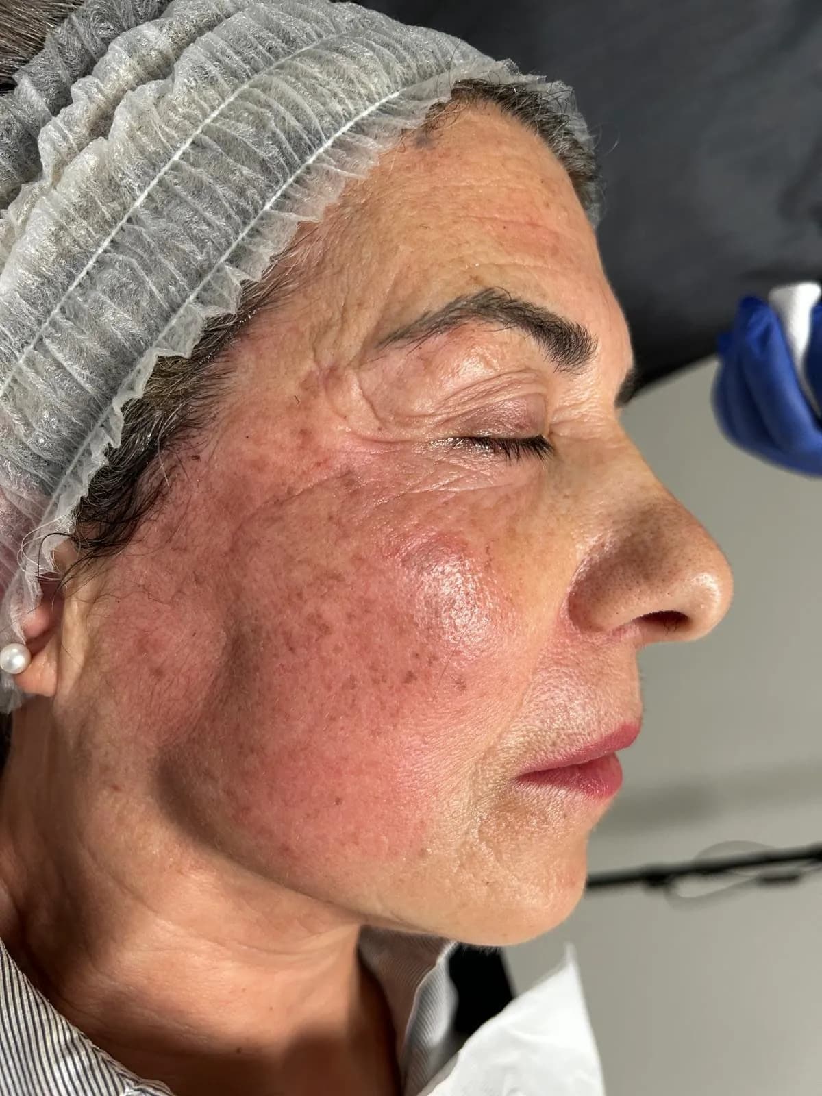 Prima trattamento macchie caso 1