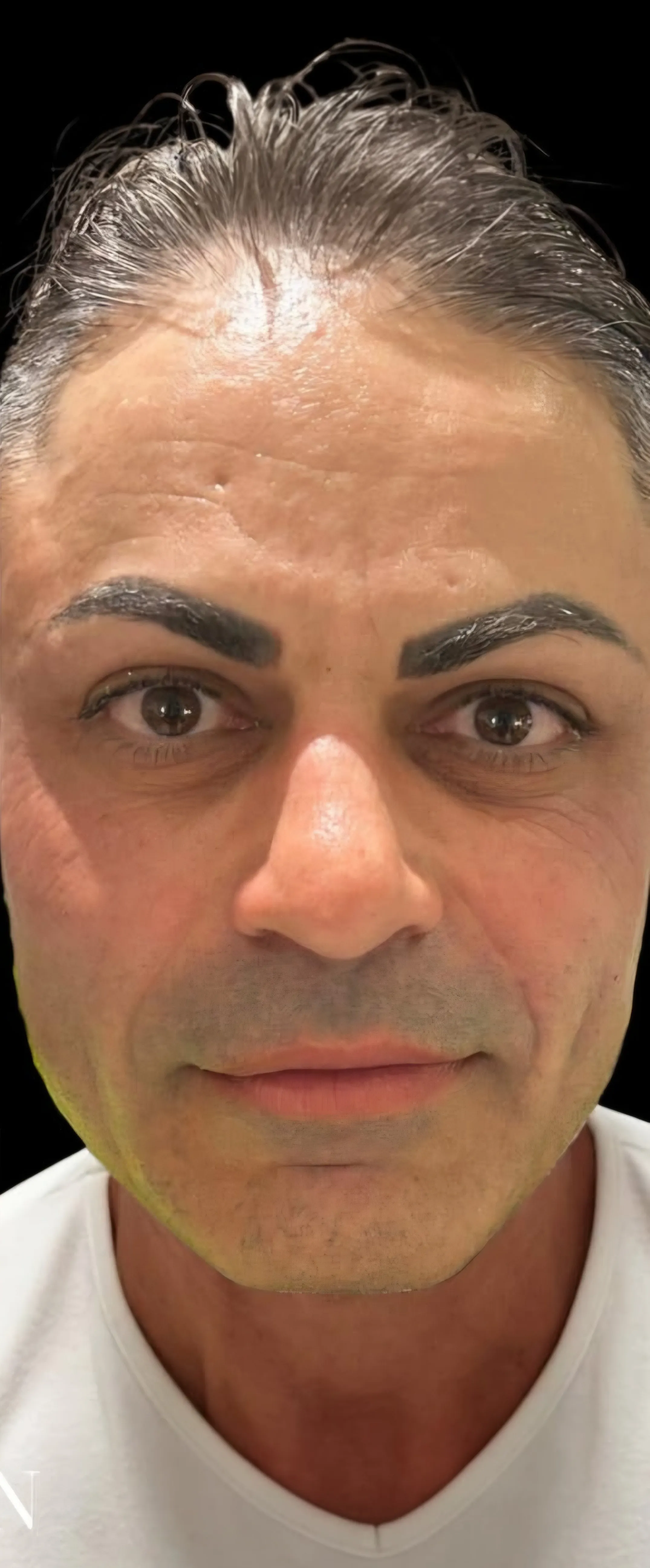 Dopo trattamento viso