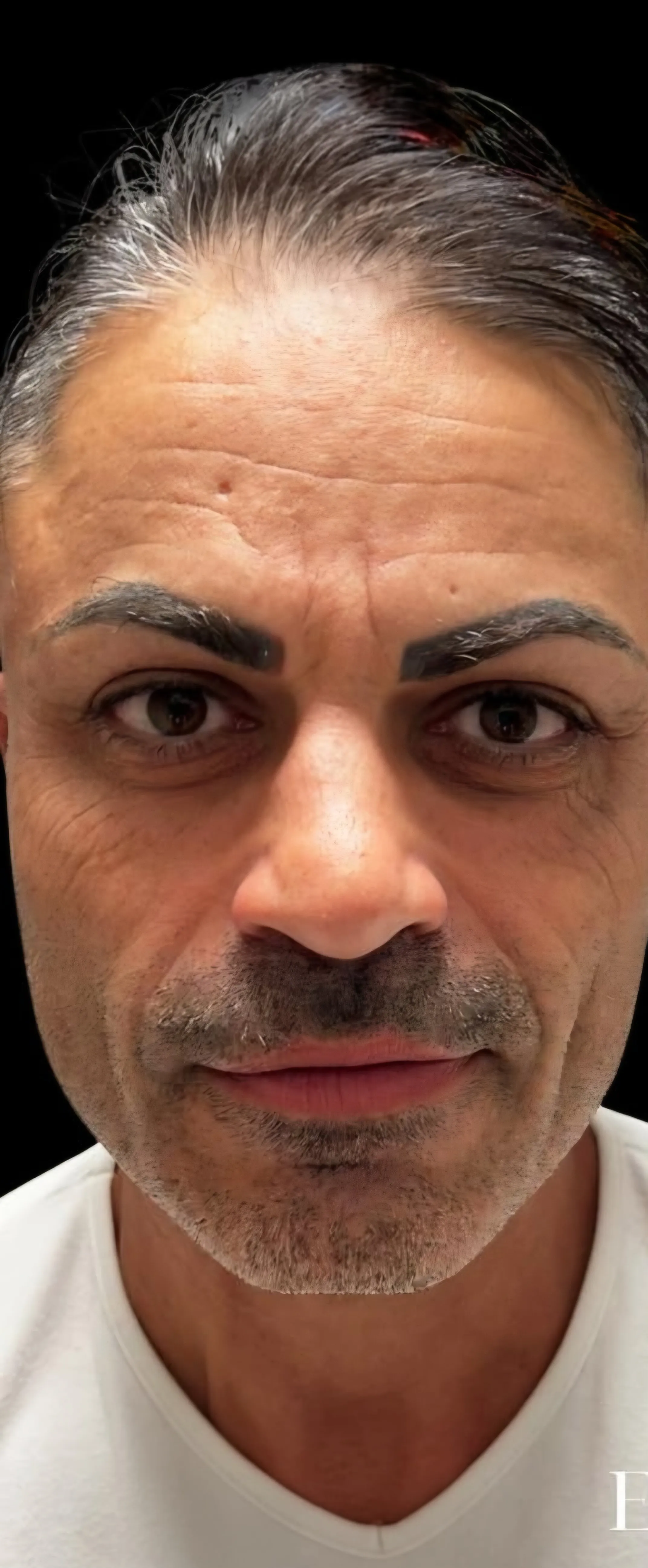 Prima trattamento viso