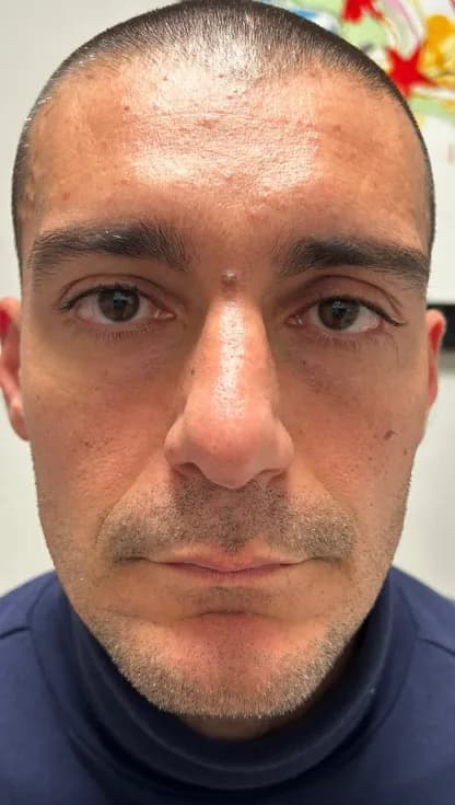 Prima trattamento 1 a Catania