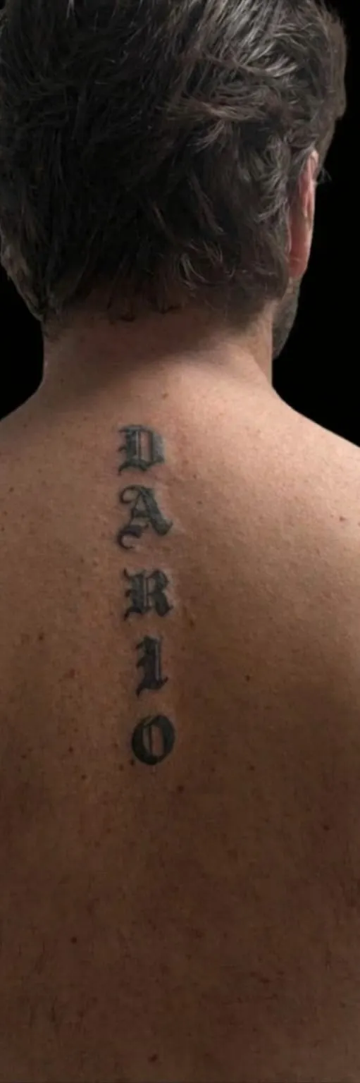 Prima rimozione tatuaggio